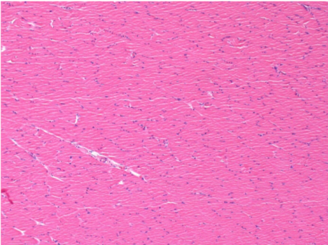 left control- 100xD30